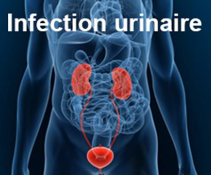 L'infection Urinaire Chez L'enfant - Votre Santé